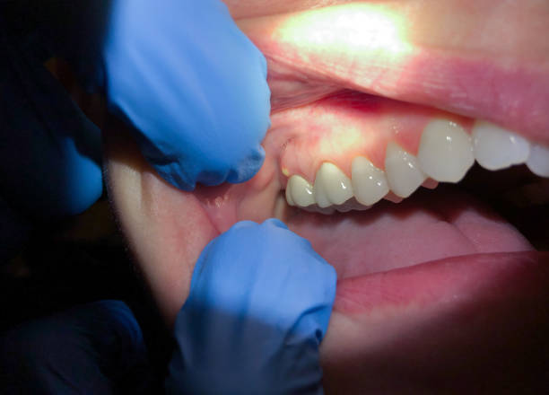 Urgent Tooth Repair in KS