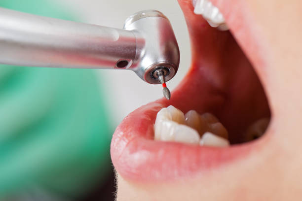 Best Root Canal Emergency Dentist  in Osborne, KS